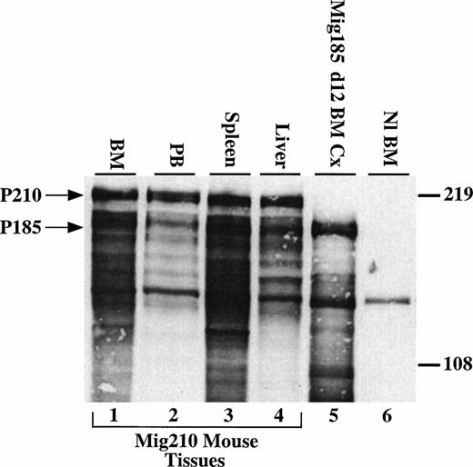 Fig. 4. P210 bcr/abl is expressed in tissues involved in the myeloproliferative process. Cells (5 × 106) were loaded per lane and detected with the 8E9 abl-specific monoclonal antibody (Pharmingen). Many of the lower molecular weight bands are most likely the result of proteolysis due to the high percentage of neutrophils in the cell lysates.28 Lanes 1 through 4, bone marrow, peripheral blood, spleen, and liver cells from a Mig210 mouse. Lane 5, day-12 cells from bone marrow cultures transduced with Mig185. Mig185 is similar to Mig210, except Mig185 expresses P185 bcr/abl (Miller and Pear, unpublished data). Lane 6, Balb/c bone marrow cells. The band at approximately 140 kD in all lanes is c-abl. Arrows indicate the 210- and 185-kD proteins.