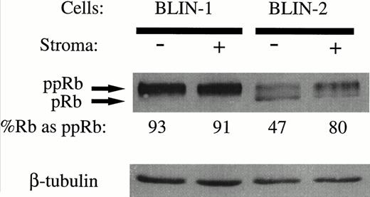 Fig. 11. Phosphorylation of Rb in BLIN-2 cells cultured in the presence or absence of BM stromal cells. BLIN-1 or BLIN-2 cells were cultured in X-VIVO 10 serum-free medium for 18 hours in the absence (−) or presence (+) of BM stromal cells. The cells were then harvested and lysed in 0.5% NP-40, and approximately 50 μg of protein per lane was electrophoresed on a 10% SDS-PAGE gel. The separated proteins were then transferred to nitrocellulose and Western blotted with rabbit antihuman Rb. The blot was restained with mouse antihuman β tubulin to control for equal protein loading. The numbers under each lane represent the percentage of Rb detected as the hyper-phosphorylated isoform (ppRb ÷ pRb + ppRb) by scanning densitometry.