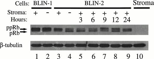 Fig. 12. Time course of Rb phosphorylation in BLIN-2. Lanes 1 through 4, BLIN-1 and BLIN-2 were cultured for 18 hours and analyzed for Rb expression/phosphorylation as described in the Fig 10 legend. Lanes 5 through 9, BLIN-2 cells from lane 4 were replated on fresh BM stromal cells and reanalyzed at the times indicated for Rb expression/phosphorylation. The blot was restained with mouse antihuman β tubulin to control for equal protein loading.