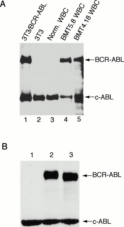 Fig. 6. Expression of Bcr-Abl/p210 protein in the peripheral WBC from a Bcr-Abl–BMT mouse with the myeloproliferative disorder and expression of the wild-type and kinase-negative mutant Bcr-Abl/p210 proteins in NIH 3T3 cells. (A) Peripheral WBC from two Bcr-Abl–BMT mice with the myeloproliferative disorder (BMT4.18 and BMT5.8) were lysed directly in SDS sample buffer. The total cell lysates were subjected to Western blot analysis with anti-Abl monoclonal antibody Ab-3. The position of Bcr-abl/p210 and endogenous c-Abl is indicated. Total cell lysates from uninfected NIH3T3 and NIH3T3 infected with retrovirus containing the bcr-abl/p210 gene were used as negative and positive controls, respectively. (B) NIH 3T3 cells infected with equal amounts (1 mL) of MSCV-IRES-gfp (lane 1), MSCV-bcr-abl/p210-IRES-gfp (lane 2), and MSCV-K1176R-IRES-gfp (lane 3) retroviral supernatants of equal titer were subjected to Western blot analysis with anti-Abl monoclonal antibody Ab-3.