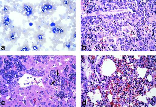 Fig. 3. Pathological analysis of the Bcr-Abl–BMT mice. (a) Peripheral blood smear from a primary Bcr-Abl–BMT mouse with the myeloproliferative disorder (original magnification × 600). The peripheral blood smear was stained with LeukoStat from Fisher. (B through D) Histological sections (original magnification × 400) of the spleen (b), liver (c), and lung (d) from a primary Bcr-Abl–BMT mice with the myeloproliferative disorder. Histological sections were stained with hematoxylin and eosin. Arrows in (c) point out mitotic hematopoietic cells.