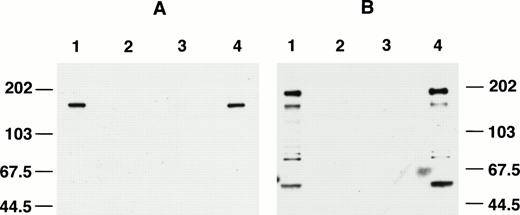 Fig. 2. Blocking of anti-C15 (A) and anti-C9 (B) by immnunizing antigens. Km3 cell lysate was separated in 8% SDS-PAGE and electrophoretically transferred onto a nitrocellulose membrane. The blots were cut into strips and Western blotting was performed using various preparations of primary antibodies. (A) Lane 1, anti-C15 versus cell lysate; lane 2, preimmune IgG; lane 3, anti-C15 blocked by immunizing antigen; lane 4, anti-C15 blocked with GST. (B) Lane 1, anti-C9; lane 2, preimmune IgG; lane 3, anti-C9 blocked by immunizing antigen; lane 4, anti-C9 blocked by GST.