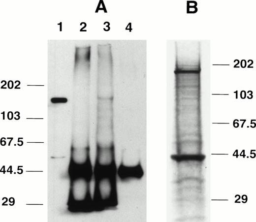 Fig. 3. Immunoprecipitation using anti-C15. (A) Immunoprecipitation followed by Western blotting. Lane 1, Km3 cell lysate without immunoprecipitation; lane 2, unlabeled Km3 lysate immunoprecipitated with preimmune IgG; lane 3, Km3 lysate immunoprecipitated with anti-C15; lane 4, anti-C15 with no lysate. The protein samples were separated in 8% SDS-PAGE, transferred to a nitrocellulose membrane, and probed with anti-C15. (B) Immunoprecipitation of radiolabeled proteins. 35S-labeled Km3 lysate (300 μL) was precleared with preimmune IgG and incubated with 1 μg anti-C15 for 3 hours at 4°C. The immune complex was pelleted by protein A/G beads, washed, separated by 10% SDS-PAGE, and autoradiographed.