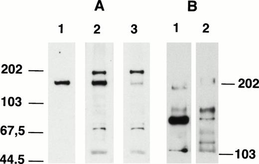 Fig. 4. Comparison of Western blotting patterns of anti-C15 and anti-C9. (A) Km3 lysate (20 μg/lane) was separated in 8% SDS-PAGE, transferred to nitrocellulose paper, and probed with anti-C15 (lane 1), anti-C15 plus anti-C9 (lane 2), and anti-C9 (lane 3). (B) K562 lysate (20 μg/lane) was separated in 4% SDS-PAGE, transferred to nitrocellulose paper, and probed with anti-C15 (lane 1) and anti-C9 (lane 2).