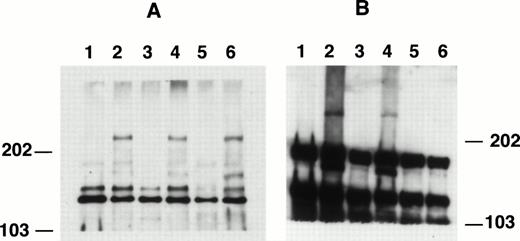Fig. 5. Western blotting patterns of anti-C15 and anti-C9 in 4% SDS-PAGE. Cell lysates were separated by SDS-PAGE, electrophoretically transferred to nitrocellulose membranes, and probed with affinity-purified anti-C15 (A) or anti-C9 (B). Lane 1, Nalm-6; lane 2, RS4;11; lane 3, Km3; lane 4, Sem-k2; lane 5, K562; lane 6, B1.