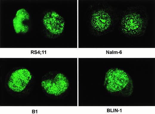 Fig. 6. Indirect immunofluorescence microscopy. Cultured cells in log phase were harvested and adjusted to 1 to 2 × 105/mL. The cells were attached to microscope slides by cytospin. The cells were probed with anti-C15 followed by goat antirabbit IgG conjugated to FITC. The image of the stained cells was obtained by a Bio-Rad MR C600 confocal microscope and processed using Adobe photoshop software. The cell lines used are indicated.