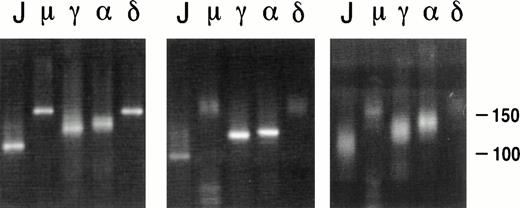 Fig. 2. PCR analysis on the CDR3 region of lymphomas no. 6 (left panel) and 7 (middle panel) and the pseudolymphoma (right panel). The FR3 primer was used as upstream primer, and JHseq, Cμ, Cγ2, C, and Cδ primers were used as downstream primers, as indicated above the lanes.