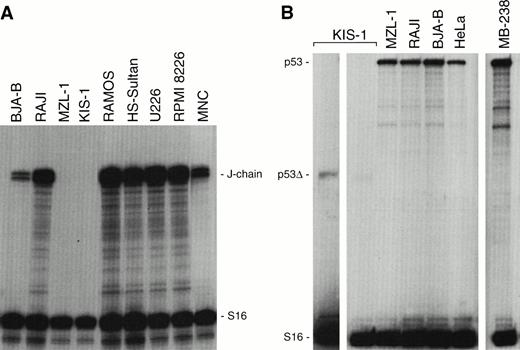 Fig. 9. J-chain and p53 gene expression in KIS-1 and MZL-1 lymphomas. (A) Absence of J-chain gene expression in B lymphocytes carrying the t(9;14) translocation. Human B-cell lines (BJA-B, Raji, Ramos, HS-Sultan), myeloma cell lines (U226, RPMI 8226), KIS-1 cells and mononuclear blood cells of patient MZL-1 as well as of a control individual (MNC) were analyzed by RNase protection assay for J-chain and S16 mRNA expression. (B) Normal p53expression in tumors overexpressing PAX-5. The p53 mRNA levels were quantitated by RNase protection analysis in a subset of the cells studied in panel A. MB-238 refers to the tumor that exhibits the highest PAX-5 expression level within a large medulloblastoma collection.20 The KIS-1 cells carry a mutation resulting in a truncated p53 mRNA (p53▵) that is detected on the longer autoradiographic exposure shown to the left.