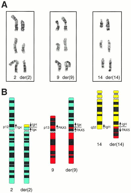 Fig. 3. Cytogenetic anallysis of the complex t(2;9;14) translocation of patient MZL-1. (A) Partial karyotype of three representative metaphase nuclei. The normal homologues (left) and the derivative (der) chromosomes (right) of the t(2;9;14)(p12;p13;q32) translocation are shown in their G-banded form. (B) Schematic representation of the t(2;9;14) translocation. Ideograms of the normal and derivative chromosomes are shown together with the location and transcriptional direction of the Igκ, IgH, andPAX-5 genes.