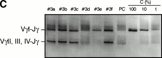 Fig. 3. PCR analysis of TCR Vγ-Jγ genes in duodenal biopsies of patients with complicated CD, untreated CD responsive to GFD, and dyspeptic controls. (A) Representative experiments using VγI-Jγ (top) and VγII, III, IV-Jγ (bottom) specific oligonucleotides. Sample numbers refer to patient numbers in Tables 1 and 2. Samples no. 2 and 3 demonstrate a clonal pattern. In patient no. 2, an identical VγI-Jγ biallelic rearrangement was found in (a) duodenal mucosa and in (b) jejunal mucosa 108 days later. In case no. 3, a monoallelic VγI-Jγ and a monoallelic VγII, III, IV-Jγ rearrangement were detected. PC, polyclonal control; C, clonal control. Dilution of the clonal control into peripheral blood lymphocytes polyclonal DNA (from 100% to 1%) has been included in the experiments and is shown for the VγII, III, IV-Jγ experiments. (B) Analysis of patient no. 4 DNAs. (Top) VγI-Jγ rearrangements. A clonal rearrangement was found in the 3 patients’ samples. (a) Duodenal biopsy at entry; (b) duodenal biopsy 30 days later; (c) peripheral blood specimen obtained 64 days later at the moment of overt lymphoma. PBL, peripheral blood lymphocytes from a polyclonal control. (C) Analysis of patient no. 3 DNAs by multiplex PCR. (a) Duodenal biopsy; (b through f) postmortem samples obtained 30 months later. (b) Small bowel; (c) colon; (d) thoracic lymph nodes; (e) mesenteric lymph nodes; (f) colonic mucosa. PC, polyclonal control; C, dilution of the clonal control into peripheral blood lymphocytes polyclonal DNA (from 100% to 1%).