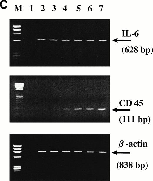 Fig. 2. CD45 expression was induced by IL-6 and lost on its withdrawal. (A) Flow-sorted CD45− U-266 cells were cultured in medium alone (left) or in medium + IL-6 (2 ng/mL; right), and cells were analyzed by flow cytometry after staining with PE-Cy5-CD45 and FITC-CD38. The percentage of CD45+ cells is indicated on each flow cytogram. (B) CD45−IL-6–independent KMS-5 cells were cultured with or without exogenous IL-6 (2 ng/mL) and analyzed after staining by PE-Cy5-CD45 and FITC-CD38. (C) RT-PCR analysis of β-actin, CD45, and IL-6 of CD45− U-266 cells cultured with IL-6. Lane M, ◊ X174/Hae III digest DNA size marker; lane 1, negative control without RT product; lanes 2, 3, 4, 5, and 6, IL-6–treated CD45− cells at day 0, 2, 4, 6, and 8, respectively; lane 7, CD45+ U-266 cells. (D) Flow-sorted CD45+ U-266 cells were incubated in medium without IL-6. Cells were stained with PE-CD45 and FITC-CD38 and subjected to flow cytometric analysis as described in Materials and Methods. The percentage of CD45+ cells is indicated on each flow cytogram. (E) Flow-sorted CD45+ U-266 cells were cultured without exogenous IL-6 for 2 weeks (left), and only CD45+ fraction was sorted out and incubated with or without IL-6 (2 ng/mL) for another 2 weeks (middle). Both CD45+ and CD45− fractions were separately sorted out and cultured for 5 days with and without IL-6 (right). The percentages of both CD45+ and CD45− fractions are indicated on each flow cytogram.