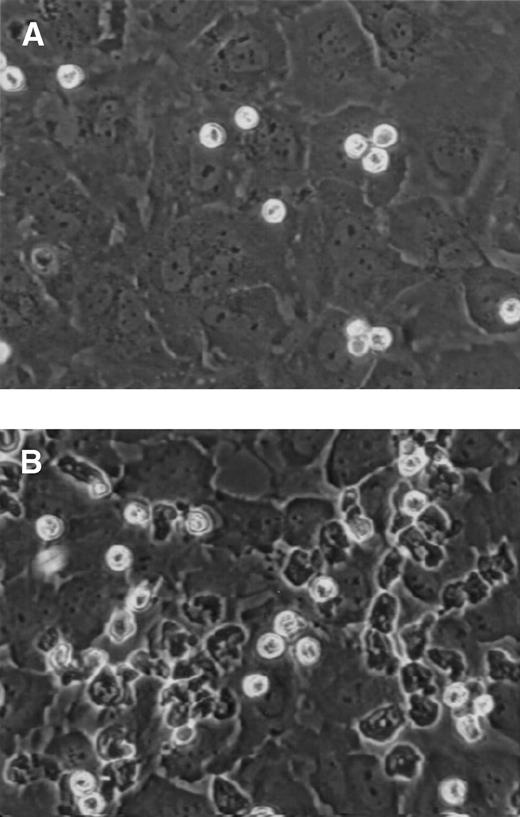 Fig. 2. Eosinophils bound to IL-4–stimulated HUVECs. Eosinophils were perfused over (A) control or (B) IL-4–stimulated HUVECs as described in Fig 1. After attachment under shear conditions, video images were obtained using a ×40 objective. These images were captured as described in Materials and Methods and photographs were made. Eosinophils bound to control HUVECs (A) remain phase-bright, whereas eosinophils bound to IL-4–stimulated HUVECs (B) change shape and spread on the monolayer.