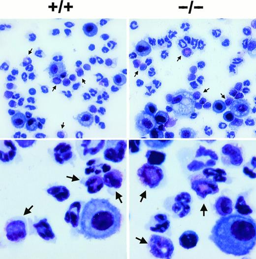 Fig. 4. Staining of eosinophils from the BAL fluid of wild-type (+/+) and eotaxin null (−/−) mice. Lung lavage was performed at 18 hours after OVA aerosol challenge and the cells were stained by Diff-Quick staining after cytospin. Representative pictures are shown for each genotype in lower (upper panel) and higher (lower panel) magnification. Arrowheads indicate eosinophils.