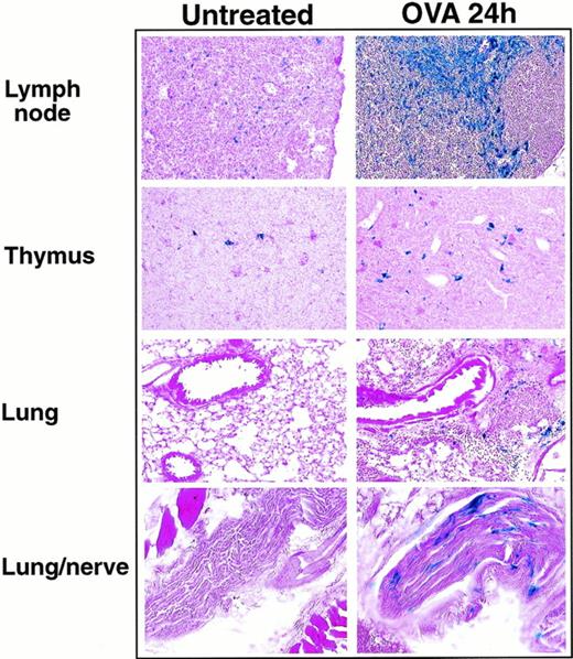 Fig. 5. The expression of βgalactosidase in lung, thymus, and lymph nodes 24 hours after ovalbumin aerosol challenge. Frozen sections of lung, thymus, and lymph nodes from untreated or ovalbumin aerosol-challenged (OVA 24 hours) mice were stained with X-gal overnight followed by counter-stain with eosin. Shown are results from a representative experiment.