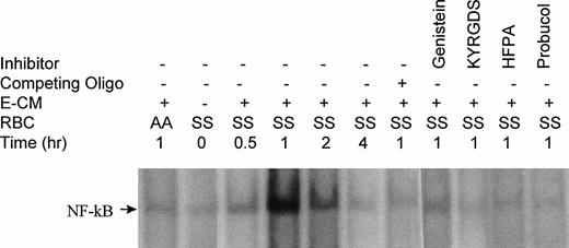 Fig. 1. Effect of incubation of RBC and inhibitors on NF-kB activity in HUVEC nuclear extracts by gel-shift assay. HUVEC were incubated with RBC (2% Hct) in the presence of E-CM (100 μg/mL) for 60 minutes, unless otherwise indicated in the presence and absence of inhibitors (genistein, 25 μg/mL; KYRGDS, 100 μmol/L; HFPA, 10 μmol/L; and probucol, 50 μmol/L). Nuclear extracts were prepared and incubated with a double-stranded 32P-labeled NF-kB oligonucleotide probe. Where indicated, excess cold competitor oligonucleotide was added to the nuclear extracts and incubated for 10 minutes before addition of radiolabeled DNA probe. The data are representative of four independent experiments.