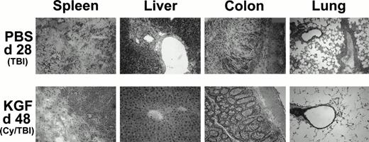 Fig. 6. Histologic assessment of GVHD in BMS (15 × 106 spleen cells) recipients on day 28 (PBS, TBI group) and day 48 (KGF, Cy/TBI group) after allogeneic BMT. H&E-stained cryosections of spleen, liver, colon, and lung of a representative mouse taken from the indicated treatment groups at these time points show that KGF can abrogate GVHD-induced manifestation in the liver and lung and moderately so in the spleen and colon (original magnification × 100; resolution power, 40× objective lens).