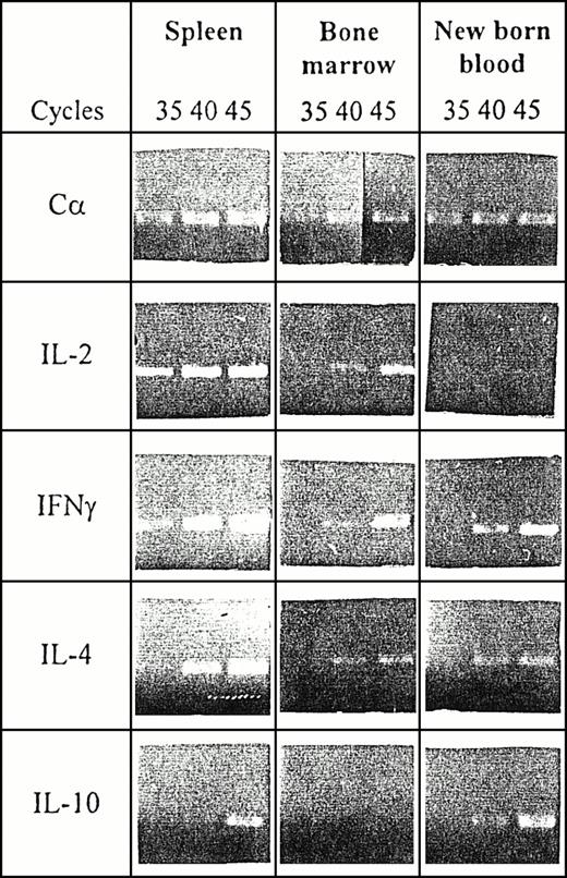 Fig. 5. IL gene expression in adult spleen, BM, and in NBB. Cells from spleen, BM, and NBB were stimulated with Con A for 24 hours and mRNA extracted. Semiquantitative RT-PCR amplification was performed on cDNA using C-, IL-2–, IFNγ-, IL-4–, and IL-10–specific primers. PCR products were analyzed on agarose gel after 35, 40, and 45 cycles of amplification.