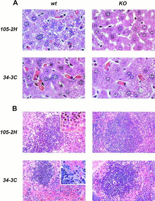 Fig. 4. Histopathology from anemic FcγRIII wild-type and FcγRIII KO mice. Representative histological appearance of liver (A) and spleen (B) from FcγRIII wild-type and FcγRIII KO mice on day 2 after AIHA-induction by the injection of the pathogenic IgG1 105-2H and IgG2a 34-3C MoAbs (hematoxylin and eosin stained; inset: higher magnification).