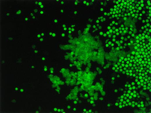 Fig. 3. Fluorescence microscopic image of a representative EGFP+ cobblestone area. The bright green cells are the mature cells on top of the stromal layer and the dim green cells represents the EGFP+ cobblestone area.