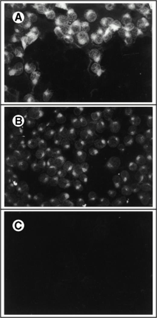 Fig. 2. Immunofluorescent detection of SCF on retroviral producer cells. Fibroblasts were stained with FITC-conjugated antibody to human SCF with (A through C) or without (D and E) permeabilization and viewed under the fluorescence microscope (×400). (A) 1MI cells following transfection but before selection in histidinol; (B) 1MI-▵SCF cells following selection and cloning; (C) untransfected 1MI cells. (B) and (C) were photographed under exactly the same exposure conditions; (D) 1MI-▵SCF cells following selection and cloning; (E) untransfected 1MI cells. (E) Is overexposed to make the cells more visible.