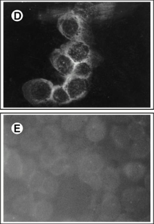 Fig. 2. Immunofluorescent detection of SCF on retroviral producer cells. Fibroblasts were stained with FITC-conjugated antibody to human SCF with (A through C) or without (D and E) permeabilization and viewed under the fluorescence microscope (×400). (A) 1MI cells following transfection but before selection in histidinol; (B) 1MI-▵SCF cells following selection and cloning; (C) untransfected 1MI cells. (B) and (C) were photographed under exactly the same exposure conditions; (D) 1MI-▵SCF cells following selection and cloning; (E) untransfected 1MI cells. (E) Is overexposed to make the cells more visible.