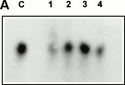 Fig. 3. (A) Expression of SCF mRNA by retroviral producer cells. 1MI cells transfected with the plasmid pREP8▵SCF were selected in histidinol and individual clones isolated. RNA was extracted from four independently isolated clones and analyzed by Northern blot. The blot was hybridized to an SCF cDNA probe. Lane C, pREP8▵SCF plasmid DNA digested with BamH1 and HindIII to release the SCF cDNA fragment; lanes 1 through 4, four independent clones of transfected 1MI cells. (B) Retroviral titer of fibroblast clones isolated following transfection with pREP8▵SCF. Culture supernatants were collected from four independent clones of 1MI cells following transfection with plasmid pREP8▵SCF. Twenty-five microliters (top row) or 2.5 μL (bottom row) of supernatant was spotted onto the surface of a nylon filter using a dot blot manifold and hybridized with a probe for p47phox. Lanes 1 through 4, supernatants from four independently isolated clones; (+), retroviral genomic DNA plasmid containing p47phox cDNA ; (−) , wild-type retroviral genomic DNA plasmid. (C) Proliferation assay on TF-cells. Biological activity of the membrane-bound growth factor on the surface of the 1MI-▵SCF cell line was assayed by 3H thymidine incorporation into quiescent TF-1 cells. sSCF, TF-1 cells stimulated with 50 ng/mL recombinant human SCF; 1MI-▵SCF, TF-1 cells cocultured for 24 hours with the 1MI-▵SCF cell line; 1MI-▵SCF + sSCF, TF-1 cells cocultured for 24 hours with the 1MI-▵SCF cell line and 50 ng/mL recombinant human SCF; 1MI-▵SCF + Transwell, TF-1 cells cocultured for 24 hours with the 1MI-▵SCF cell line, where the TF-1 cells were suspended in a Transwell. Incorporation was corrected for background values obtained with unstimulated TF-cells and 1MI-▵SCF cells, as appropriate.