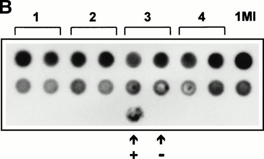Fig. 3. (A) Expression of SCF mRNA by retroviral producer cells. 1MI cells transfected with the plasmid pREP8▵SCF were selected in histidinol and individual clones isolated. RNA was extracted from four independently isolated clones and analyzed by Northern blot. The blot was hybridized to an SCF cDNA probe. Lane C, pREP8▵SCF plasmid DNA digested with BamH1 and HindIII to release the SCF cDNA fragment; lanes 1 through 4, four independent clones of transfected 1MI cells. (B) Retroviral titer of fibroblast clones isolated following transfection with pREP8▵SCF. Culture supernatants were collected from four independent clones of 1MI cells following transfection with plasmid pREP8▵SCF. Twenty-five microliters (top row) or 2.5 μL (bottom row) of supernatant was spotted onto the surface of a nylon filter using a dot blot manifold and hybridized with a probe for p47phox. Lanes 1 through 4, supernatants from four independently isolated clones; (+), retroviral genomic DNA plasmid containing p47phox cDNA ; (−) , wild-type retroviral genomic DNA plasmid. (C) Proliferation assay on TF-cells. Biological activity of the membrane-bound growth factor on the surface of the 1MI-▵SCF cell line was assayed by 3H thymidine incorporation into quiescent TF-1 cells. sSCF, TF-1 cells stimulated with 50 ng/mL recombinant human SCF; 1MI-▵SCF, TF-1 cells cocultured for 24 hours with the 1MI-▵SCF cell line; 1MI-▵SCF + sSCF, TF-1 cells cocultured for 24 hours with the 1MI-▵SCF cell line and 50 ng/mL recombinant human SCF; 1MI-▵SCF + Transwell, TF-1 cells cocultured for 24 hours with the 1MI-▵SCF cell line, where the TF-1 cells were suspended in a Transwell. Incorporation was corrected for background values obtained with unstimulated TF-cells and 1MI-▵SCF cells, as appropriate.