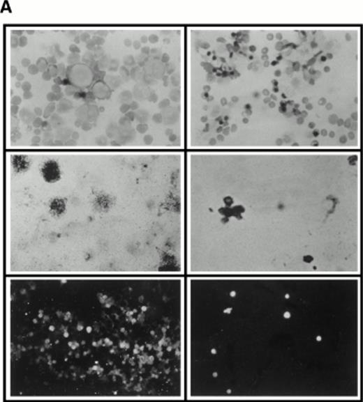 Fig. 4. (A) Selection of quiescent bone marrow cells using 5-FU. Bone marrow mononuclear cells were incubated for 7 days in IMDM either supplemented with IL-3, SCF, and 5-FU to kill dividing cells (right-hand panels) or not (left-hand panels). At 4 days of incubation an aliquot was spun onto microscope slides and stained with Wright’s stain (top panels). Twenty-four hours before harvesting, 3H thymidine was added to the cultures. Following 7 days incubation cells were obtained and spun onto microscope slides. The slides were dipped in photographic emulsion and exposed for 7days before being developed, counterstained with Wright’s stain, and visualized under the light microscope (middle panels). (Bottom panels) Cells as above, but stained with antibody to c-kit and viewed under fluorescence. (B) Long-term culture. 5-FU–selected cells were plated on monolayers of bone marrow derived fibroblast as described in Materials and Methods and used to initiate long-term bone marrow cultures. The arrows show areas of extensive lipid deposition characteristic of these types of culture. Arrowheads identify “cobblestone areas,” clusters of developing hematopoietic cells.