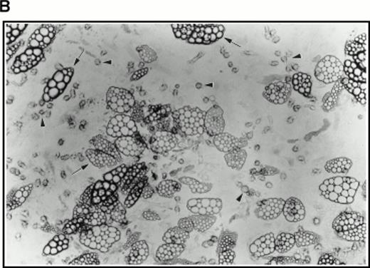 Fig. 4. (A) Selection of quiescent bone marrow cells using 5-FU. Bone marrow mononuclear cells were incubated for 7 days in IMDM either supplemented with IL-3, SCF, and 5-FU to kill dividing cells (right-hand panels) or not (left-hand panels). At 4 days of incubation an aliquot was spun onto microscope slides and stained with Wright’s stain (top panels). Twenty-four hours before harvesting, 3H thymidine was added to the cultures. Following 7 days incubation cells were obtained and spun onto microscope slides. The slides were dipped in photographic emulsion and exposed for 7days before being developed, counterstained with Wright’s stain, and visualized under the light microscope (middle panels). (Bottom panels) Cells as above, but stained with antibody to c-kit and viewed under fluorescence. (B) Long-term culture. 5-FU–selected cells were plated on monolayers of bone marrow derived fibroblast as described in Materials and Methods and used to initiate long-term bone marrow cultures. The arrows show areas of extensive lipid deposition characteristic of these types of culture. Arrowheads identify “cobblestone areas,” clusters of developing hematopoietic cells.