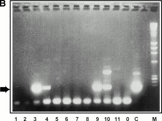 Fig. 6. Retroviral transduction of 5-FU–selected bone marrow cells. (A) Schematic of experimental plan for analysis of retroviral transduction of 5-FU–selected bone marrow cells. (B) PCR analysis of 5-week LTC-IC–derived colonies plated in semisolid media. Individual colonies arising from 5-FU–selected cells plated in 5-week long-term cultures were picked into separate tubes and the genomic DNA subjected to PCR with primers specific for the retroviral genome. The PCR products were separated by electrophoresis on 2% agarose gels, stained with ethidium bromide, and visualized under ultraviolet light. Lanes 1 through 11, colonies picked from semisolid media, following transduction on 1MI-▵SCF cell line; lane 0, DNA (1 μg) from AM12 cell line; lane C, DNA (1μg) from 1MI parent cell line; lane M,HindIII digest of phage λ DNA and HaeIII digest of phage ▹X174 DNA used as size markers. The arrow denotes the expected size of the PCR product specific to the p47phox-containing retroviral genome.