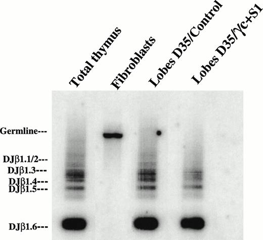 Fig. 5. Fetal thymic organ cultured cells expressed multiple DJβ rearrangements. Genomic DNA was isolated from thymocytes generated from CD34+ CB cells (lobes D35/control) or from CD34+ γc transduced BM patient cells (lobes D35/γ + S1) after 35 days of organ culture. DNA was then amplified by PCR using TBF1 and TBR1 primers to detect Dβ1-Jβ1 rearrangements. PCR products were blotted and hybridized with the TBR3 probe. Total thymocytes and fibroblasts served as positive and negative controls, respectively. (Right) Positions of the genomic fragment and the specific rearrangements of Dβ1 to the Jβ1-1-Jβ1-6 elements.