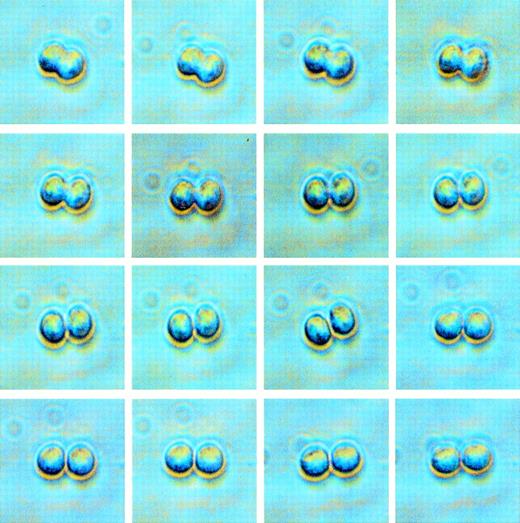 Fig. 1. Phase contrast images of a single CD34+Thy-1+lin− cell undergoing its first cell division. The time elapsed from when the beginning of division was observed (upper left) until division was complete (lower right) was approximately 25 minutes. When a doublet was observed in a well, the daughter cells were stained for phenotype assessment by fluorescence microscopy.