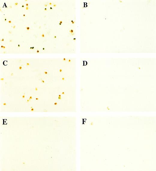 Fig. 9. GATA-1 requires the BMP pathway to cooperate with bFGF to induce erythroid cells. Embryos were coinjected with (A) β-gal RNA (1 ng) and pcDNA3–BMP-4 (200 pg); (B) ▵mTFRII RNA (1 ng) and pcDNA3–BMP-4 (200 pg); (C) β-gal RNA (1 ng) and pcDNA3–GATA-1 RNA (200 pg); (D) ▵mTFRII RNA (1 ng) and pcDNA3–GATA-1 RNA (200 pg); (E) β-gal RNA (1 ng) and control vector (200 pg); and (F) ▵mTFRII RNA (1 ng) and control vector (200 pg). Animal caps were explanted, cultured with bFGF (20 ng/mL) until sibling embryos were at stage 35, and analyzed for o-dianisidine–positive cells (Fig 1A). The panels are photographed at 20× original magnification. (G) The number ofo-dianisidine–positive cells was counted in two cytospins for each experimental condition in a single experiment. The number ofo-dianisidine cells per cap was determined as described in Fig4.