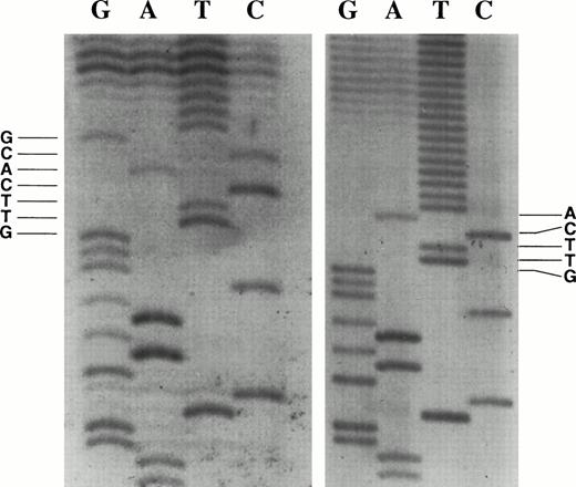 Fig. 1. RACE clones show two major transcriptional initiation sites. The transcription initiation site was identified as the base adjacent to the start of the poly T tail. (Left panel) Transcription start site at nucleotide G, base +1 in Fig 2. (Right panel) Transcription start site at nucleotide A, base +3 in Fig 2.