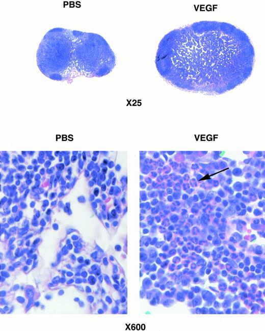 Fig. 6. Photomicrograph of lymph nodes stained with hematoxylin-eosin. (Bottom panel) Higher magnification of one of the fields in a parafollicular zone of lymph nodes. Arrow points to a group of granulocytes in the lymph node from a VEGF-treated mouse.