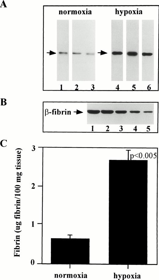 Fig. 6. Hypoxia induces fibrin deposition in TM−/− chimeric mice. (A) Western blot of β-fibrin from 6- to 11-month-old TM chimeras. Mice were paired according to agouti coat coloring and one animal from each pair was maintained under normoxic conditions (lanes 1, 2, and 3) while the other was exposed to hypoxic conditions (lanes 4, 5, and 6). Western blot analysis of urea-insoluble tissue samples was conducted using an MoAb against the amino-terminus of Bβ-fibrin. (B) Western blot of purified β-fibrin showing the standard curve containing: lane 1, 250 ng; lane 2, 150 ng; lane 3, 100 ng; lane 4, 50 ng; and lane 5, 20 ng. (C) Quantitation of cross-linked fibrin from Western blot shown in A. Values are expressed as μg β-fibrin per 100 mg of lung tissue.