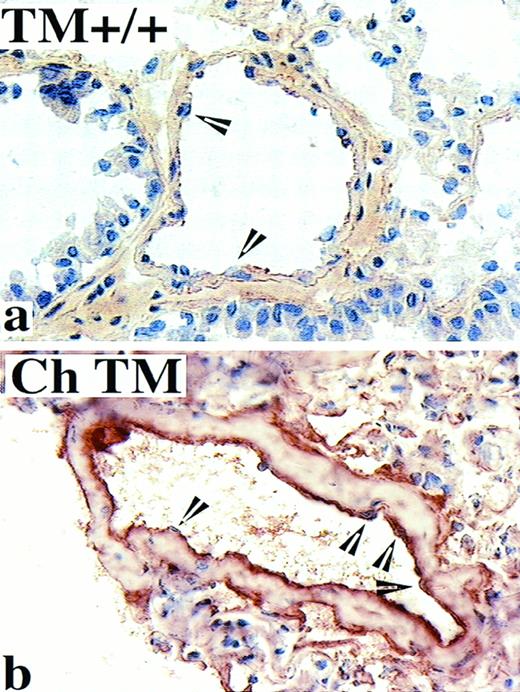 Fig. 4. Localization of acid-washed fibrin/fibrinogen in the murine pulmonary vasculature. PLP-fixed cryosections of mouse lung were acid washed to solubilize fibrinogen and fibrin degradation products before immunolocalization with an anti-fibrin/fibrinogen IgG and counterstaining with hematoxylin. Wild-type (TM+/+) mice between 15 and 20 months of age display little or no immunoreactivity at the intimal surface (representative image shown in a), whereas age-matched TM−/− chimeric (Ch TM) mice display a strong cross-linked fibrin immunolocalization at the lumenal surface of blood vessels (b). Endothelial cell nuclei are indicated by arrowheads. Original magnification × 400.