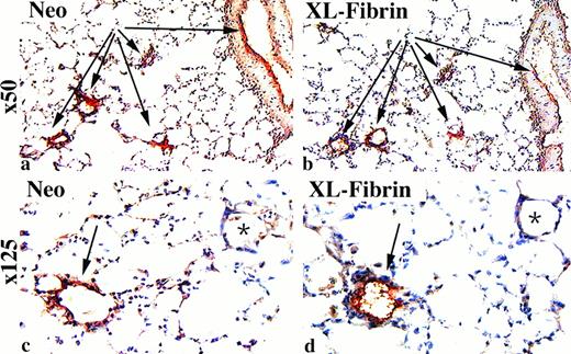 Fig. 5. Colocalization of cross-linked fibrin and neo in TM−/− chimeric mouse lung. PLP-fixed cryosections of mouse lung were stained with anti-neo antibody and acid-washed serial sections stained with the anti-fibrin/fibrinogen antibody before counterstaining with hematoxylin. Shown is a representative image from a high-percentage chimeric mouse in the 15- to 20-month age group. Low-power views of serial cross sections show that neo (a) is present in the same blood vessels that demonstrate immunoreactivity for cross-linked fibrin (XL-Fibrin, b). Higher power magnification, c and d, of the same images as shown in a and b. Arrows indicate blood vessels. Original magnification in panels a and b, × 50; panels c and d, × 125.
