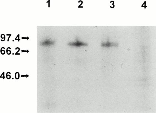 Fig. 1. Electrophoretic analysis of recombinant FXII proteins. Vaccinia virus-infected HepG2 cells were metabolically labeled and the culture media were immunoprecipitated and electrophoresed as indicated in Materials and Methods. Culture media from HepG2 cells infected with vFXII (lane 1) or with vFXII.▵19 (lane 2) immunoprecipitated with MoAb KOK5; culture media from HepG2 cells infected with vFXII (lane 3) or with vFXII.▵19 (lane 4) immunoprecipitated with MoAb B7C9.