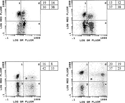 Fig. 1. Representative histograms showing simultaneous measurement of apoptosis and immunophenotype. Histograms shown represent samples from four different HIV-infected children. PBMC were labeled with anti-CD4 APC (log red fluorescence, y-axis) and then subjected to the TUNEL procedure (log green fluorescence, x-axis) to enumerate apoptotic cells. The percentage of cells in each region is shown.