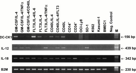 Fig. 7. Expression of DC-CK1, IL-12, and IL-18 by in vitro–generated DC. PBMNC were cultured with the indicated combinations of cytokines for 7 days. Total RNA was isolated from cultured DC, purified CD14+ and CD34+ cells, or human tumor cell lines. DC-CK1, IL-12, and IL-18 expression was examined by semiquantitative RT-PCR. Twenty-eight rounds of amplification using primers specific for DC-CK1 and IL-18, 32 cycles for IL-12 amplification, and 23 cycles for β2-microglobulin were performed. PCR products were run on a 3% agarose gel and visualized by ethidium bromide staining. Samples containing no cDNA were used as negative control.
