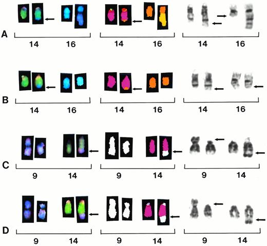 Fig. 2. Partial karyotypes from four different patients showing recurring translocations t(14;16)(q32;q22∼q23) and t(9;14)(p13;q32). Each row represents a different patient sample with brackets within each row indicating a different representation of the same reciprocal translocation. Chromosomes are presented in SKY display colors (left brackets), SKY classification colors (center brackets), and G-banding (right brackets). Patient sample no. 8 shows translocation t(14;16)(q32;q22∼23) (A). Note the apparent breakpoint 16q22 versus smaller der 16 in patient below. Patient sample no. 3 shows translocation t(14;16)(q32;q22∼23) (B). Note that the breakpoint appears lower at band 16q23 in this patient. Patient samples no. 1 and 11 show the identification of a large segment designated add 14q32 by G-banding, refined to t(9;14)(p13;q32) (C and D).