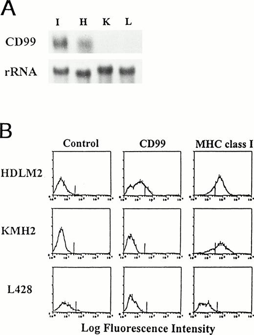 Fig. 2. Lack of CD99 expression in HD-derived cell lines. (A) Northern blot analysis for CD99 expression in HD-derived cell lines. RNA samples were prepared from IM9 (I) and three Hodgkin’s cell lines, HDLM-2 (H), KM-H2 (K), and L-428 (L), and examined for the presence of CD99 transcripts. As a loading control, the blot was reprobed with rRNA. (B) Flow cytometric analysis of HD-derived cell lines.