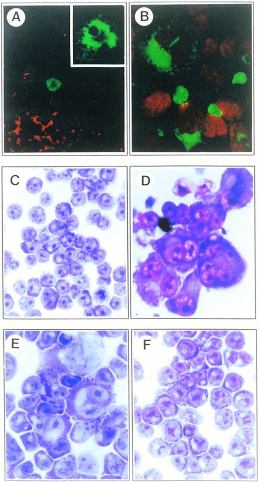 Fig. 1. Microscopic analysis of H-RS cells from the lymph nodes of an HD patient and CD99-deficient B-cell lines. (A) Examination on the distribution of CD30 and CD99 molecules in lymph nodes of an HD patient by confocal microscopy. The frozen sections of lymph nodes were double-stained with FITC-conjugated anti-CD30 and biotinylated anti-CD99 antibodies. CD99 expression was identified by incubation with Texas Red–conjugated streptoavidin. CD99 molecule is absent in H-RS cells, whereas a considerable number of surrounding activated lymphocytes show strong reactivity (original magnification × 200). A CD30+ H-RS cell is shown at higher magnification (inset; original magnification × 1,000). (B) Localization of CD15 molecules in AS-TF IM9 cells with confocal microscopic analysis. AS-TF cells were stained with FITC-conjugated anti-CD15 antibody. Propidium iodide (PI) was included for nuclear staining. Most of large cells showed intense expression of CD15 in the Golgi and cytoplamic regions as well as on plasma membrane (original magnification × 630). Both (C) Vec-TF and (D) AS-TF IM9 cells were morphologically examined after Wright and Giemsa staining. AS-TF IM9 cells show typical H-RS morphology. (E and F) Restored cell morphology by exogenous expression of CD99 in Mut-IM9 cells. (E) Spontaneous CD99-deficient IM9 cells (Mut-IM9) and (F) CD99-TF Mut-IM9 cells were examined with Wright and Giemsa staining. All slides (C-F) were processed in parallel and photographed under identical magnification (40× objective).