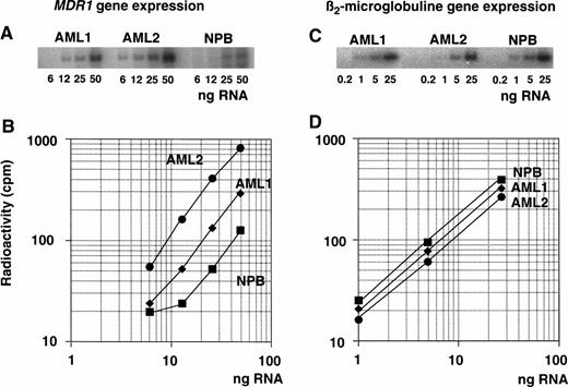 Fig. 2. Determination of MDR1 gene expression in AML patients by quantitative RT-PCR analysis. RNA isolated from AML patients (AML1 and AML2) and a healthy individual (NPB) was reverse transcribed. Each cDNA was diluted, amplified by PCR with MDR1primer pairs (A) or β2-microglobulin primer pairs (C), and subjected to autoradiography after 5% polyacrylamide gel electrophoresis and image analysis; values are plotted in graph (B and D, respectively).