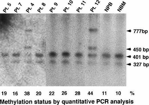 Fig. 7. Determination of methylation status of the MDR1promoter region by Southern blot analysis in AML patients, NPB, and normal bone marrow (NBM) cells. The 327-bp, 401-bp, 450-bp and 777-bp fragments were described in the legend to Fig 1. Methylation status (%) by quantitative PCR analysis is shown below the panel.
