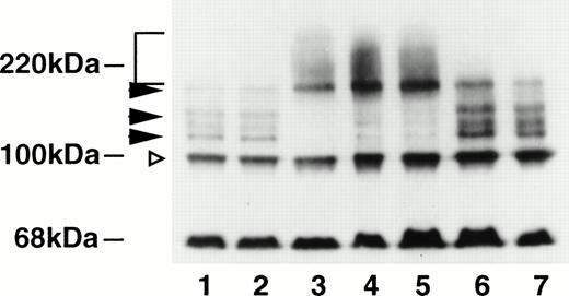 Fig. 2. Trivalent antimonials induce poly–SUMO-1 modification of wild-type PML. Cellular extracts from HeLa cells stably overexpressing PML(F) were prepared in SDS sample buffer. Cells were either untreated (lane 1) or treated with 1 μmol/L RA (lane 2), 1 μmol/L As2O3 (lane 3), 1 μmol/L Sb2O3 (lane 4), 1 μmol/L PAT (lane 5), 1 μmol/L meglumine antimonate (lane 6), or 1 μmol/L Bi2O3 (lane 7). Proteins were run on a 7.5% SDS-PAGE gel, transferred to a nitrocellulose membrane, and the blot was immunostained with a monoclonal antibody directed against the F tag. The unmodified 100-kD PML form is indicated by an open triangle. The oligo–SUMO-1–modified PML forms migrating between 120 and 160 kD are indicated by arrowheads and the high molecular poly–SUMO-1–modified PML species forming a smear toward the top of the gel by a square bracket. The ∼68-kD band represents a protein cross-reacting with the anti-F antibody that has been described previously.39