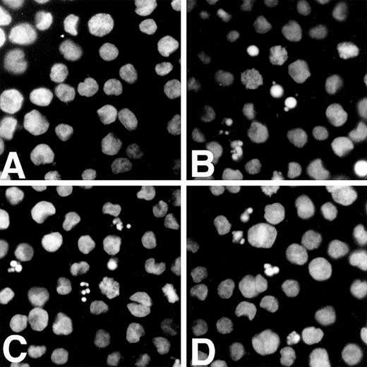 Fig. 4. Trivalent antimonials induce apoptosis of APL cells. Untreated NB4 cells (A) or cells treated for 24 hours with either 1 μmol/L As2O3 (B), 1 μmol/L Sb2O3 (C), or 1 μmol/L PAT (D) were bound to poly-Lysine treated coverslips, fixed and stained with Hoechst 33258. Apoptotic cells show chromatin condensation and micronuclei.