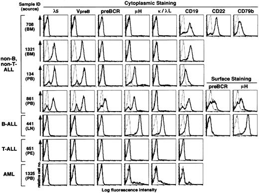 Fig. 3. Flow cytometric analysis of human acute leukemia samples by using the MoAbs HSL11, HSL96, and HSL2. Frozen samples of childhood acute leukemia were thawed and stained in the cytoplasm (in a few cases on the cell surface as well) by the MoAbs specific to λ5, VpreB, pre-BCR, μH chain, κL chain, λL chain, CD19, CD22, or CD79b in the same way as in Fig 2. Staining profiles with these MoAbs (thick solid line) and staining profiles with an isotype-matched control MoAb (thin dotted line) are overlaid in the histograms. Though data are not shown, the T-ALL sample was positive for CD3, CD4, and CD8 whereas the AML sample was positive for CD13 and CD33. All data including other leukemia samples are summarized in Tables 2 and 3. Sources of leukemia samples: BM, bone marrow; PB, peripheral blood; LN, lymph node; PE, pleural effusion.