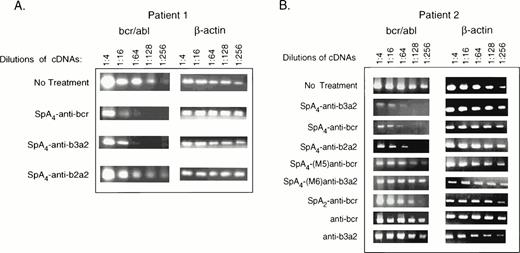 Fig. 7. Targeted degradation of bcr-abl mRNA in CML cells as determined by RT-PCR. RT-PCR products from bcr-abl and β-actin mRNAs were separated on agarose gels and stained with ethidium bromide. ODNs (as indicated in the figure) were added twice daily to CML cells from (A) patient 1 (5 μmol/L per treatment) or (B) patient 2 (2 μmol/L per treatment) for 2.5 days before isolation of RNA. The images show the PCR products stained with ethidium bromide in 1.2% agarose gels.